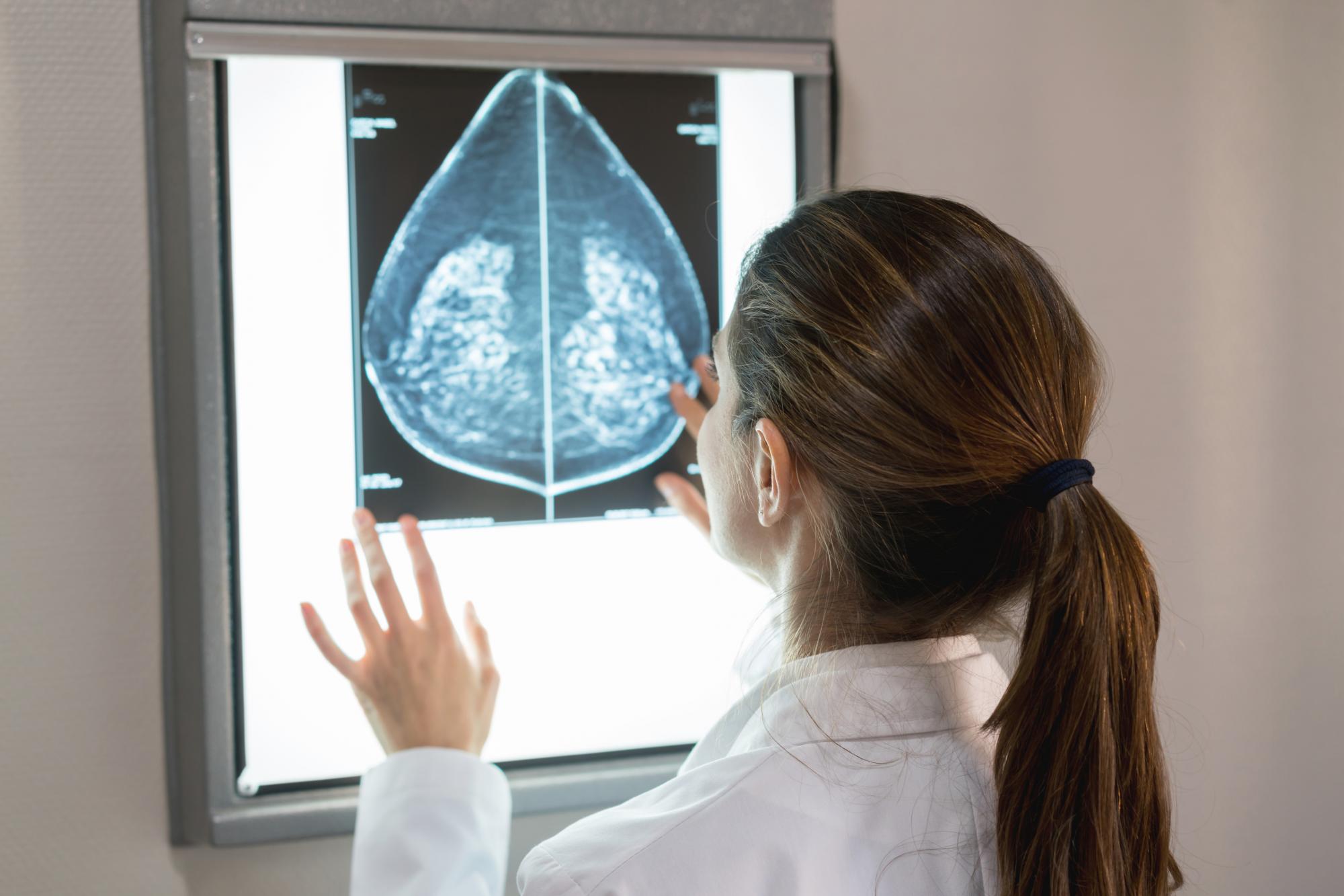 Kann man mit Brustimplantaten eine Mammographie durchführen?